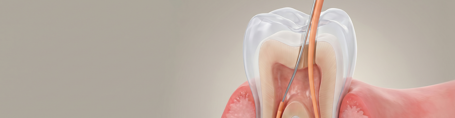 Cross-sectional illustration of a tooth undergoing a pulp capping procedure, showing a dental instrument placing protective material over the exposed pulp to preserve the tooth's vitality.